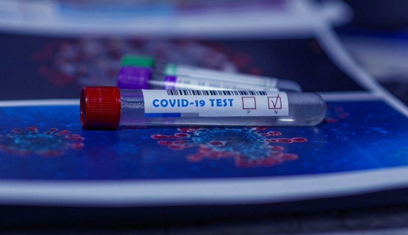 The Importance Of Performing Widespread Covid-19 Tests