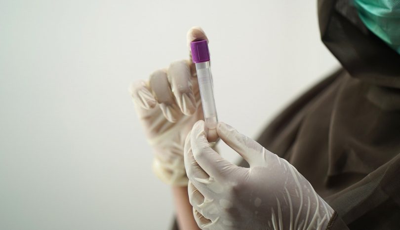 Leverage the Hepatitis Test Kit Today
