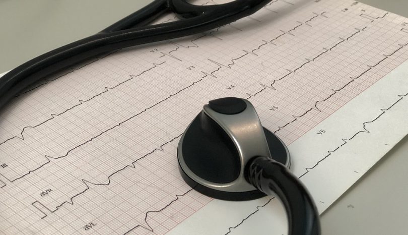 What You Need To Know About PJC ECG: The 3 Main Point