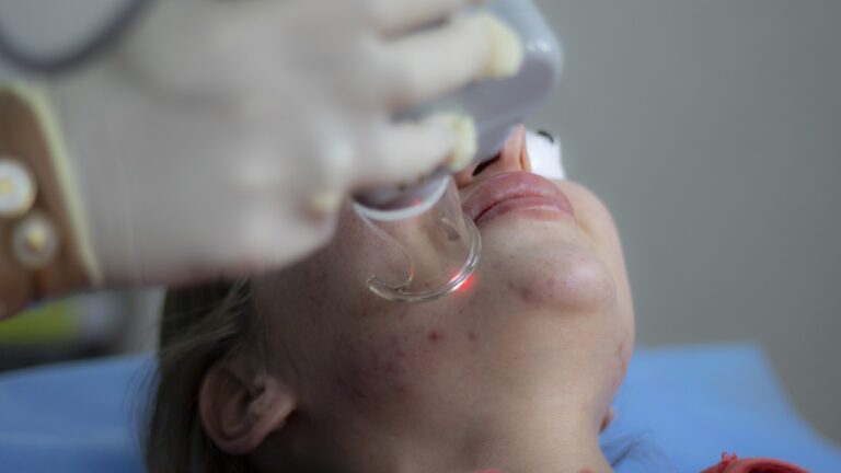 laser-treatment-6664875_1280